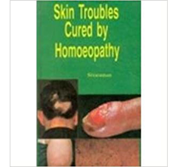 Buy Skin Troubles Cured By Homeopathy: 1