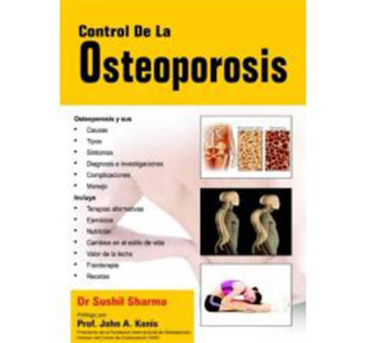 Buy Control De La Osteoporosis (Spanish)